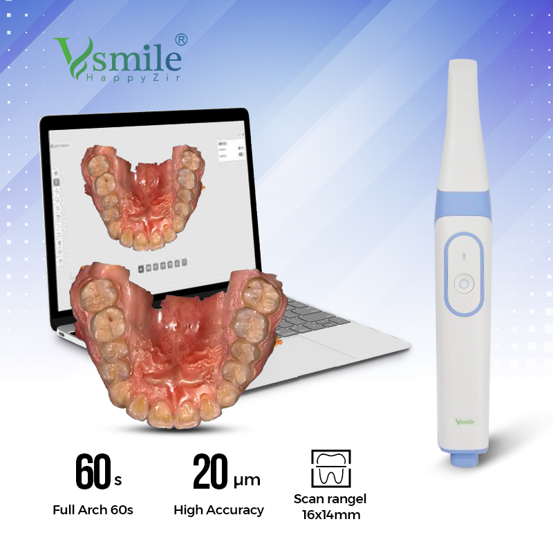 Digital 3D Intraoral Dental Scanners