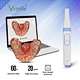 Digital 3D Intraoral Dental Scanners